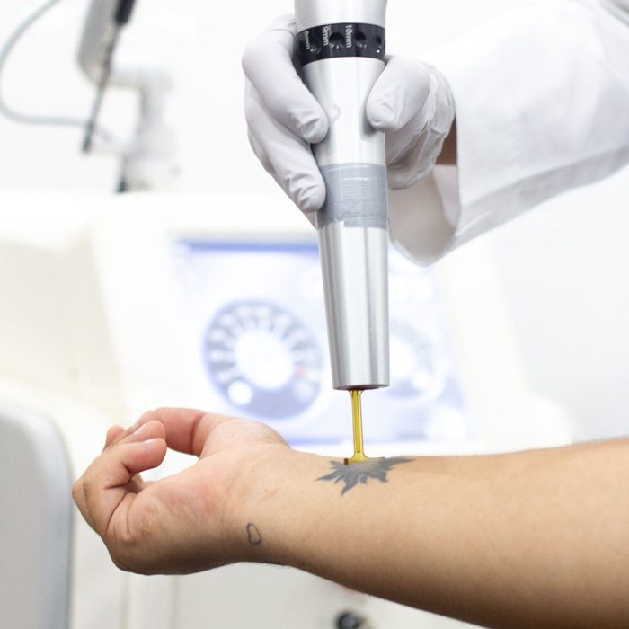 wmremove-transformed